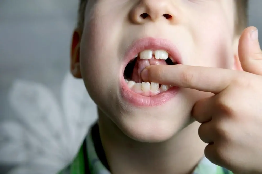 Will My Child Grow Out of Stuttering? Signs & When to Seek Help